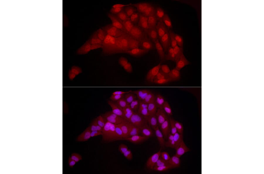 Immunofluorescence - Anti-YAP1 Antibody [ARC53477] (A308258) - Antibodies.com