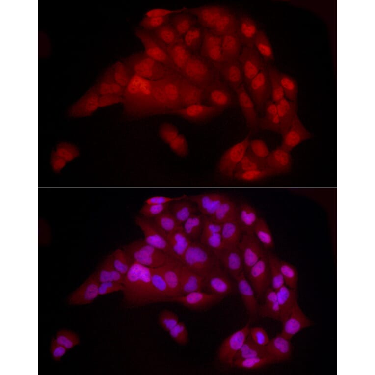 Immunofluorescence - Anti-YAP1 Antibody [ARC53477] (A308258) - Antibodies.com