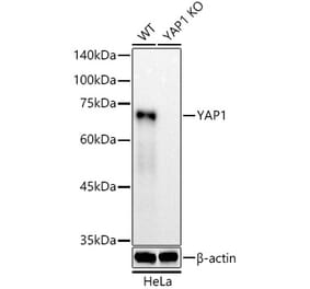 Western Blot - Anti-YAP1 Antibody [ARC53479] (A308259) - Antibodies.com