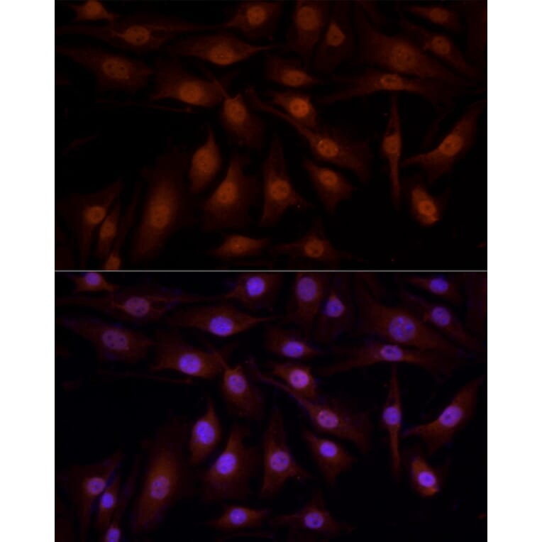 Immunofluorescence - Anti-YAP1 Antibody (A308260) - Antibodies.com