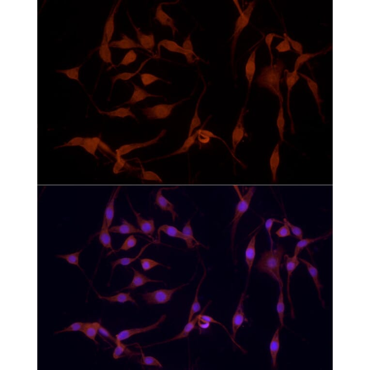 Immunofluorescence - Anti-YAP1 Antibody (A308260) - Antibodies.com