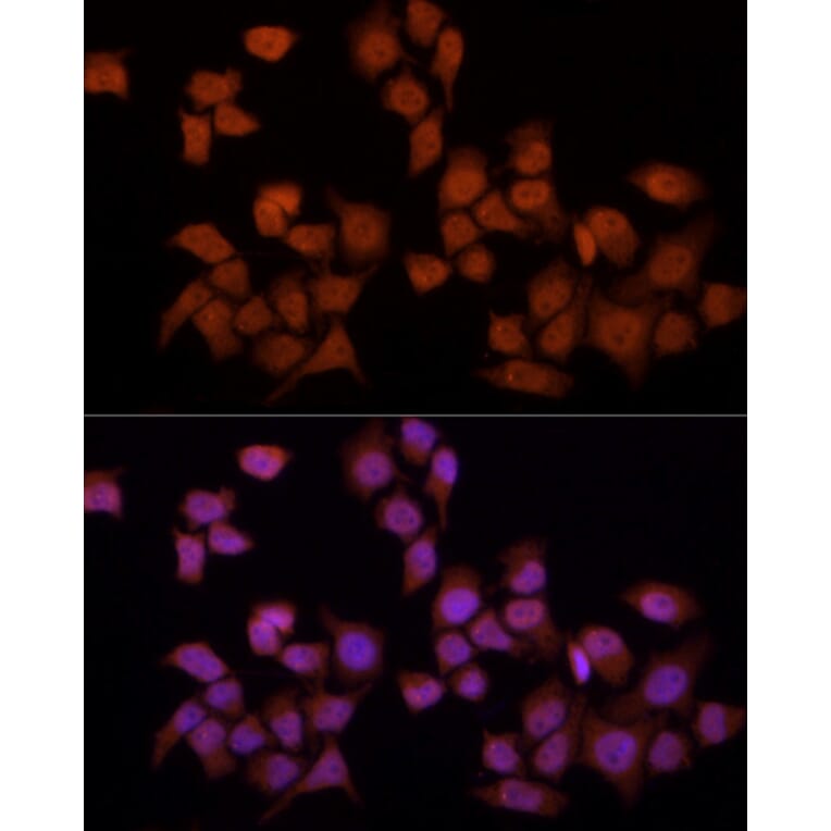 Immunofluorescence - Anti-YAP1 Antibody (A308260) - Antibodies.com