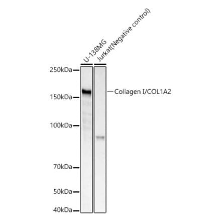 Western Blot - Anti-COL1A2 Antibody [ARC52125] (A308261) - Antibodies.com