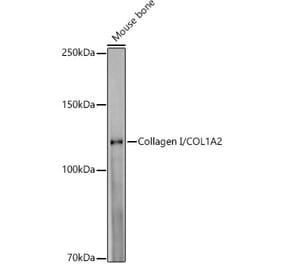 Western Blot - Anti-COL1A2 Antibody [ARC52128] (A308262) - Antibodies.com