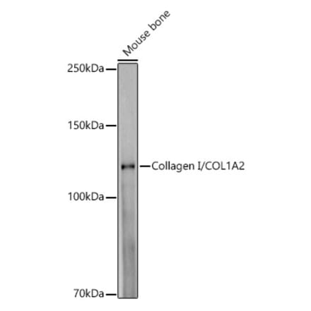 Western Blot - Anti-COL1A2 Antibody [ARC52128] (A308262) - Antibodies.com
