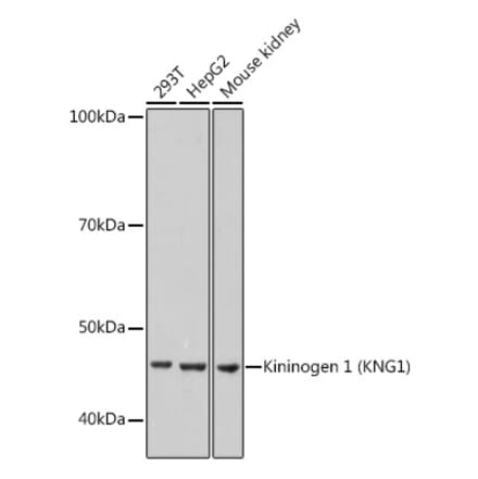 Western Blot - Anti-Kininogen 1 Antibody [ARC0653] (A308264) - Antibodies.com