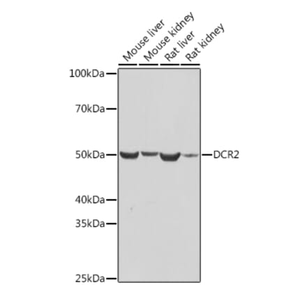 Western Blot - Anti-DcR2 Antibody [ARC2052] (A308265) - Antibodies.com