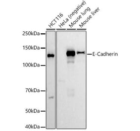Western Blot - Anti-E Cadherin Antibody [ARC51012] (A308267) - Antibodies.com