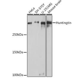 Western Blot - Anti-Huntingtin Antibody (A308268) - Antibodies.com