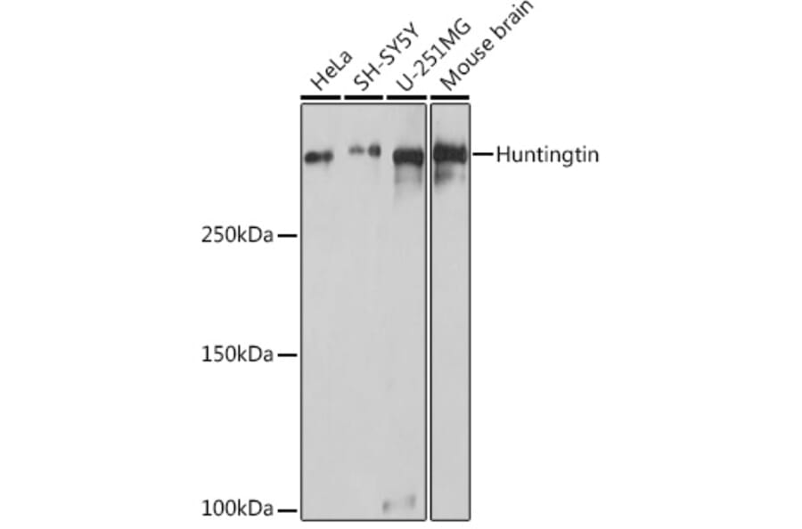 Western Blot - Anti-Huntingtin Antibody (A308268) - Antibodies.com