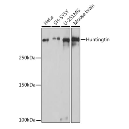 Western Blot - Anti-Huntingtin Antibody (A308268) - Antibodies.com