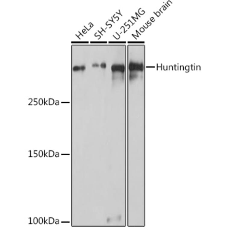 Western Blot - Anti-Huntingtin Antibody (A308268) - Antibodies.com