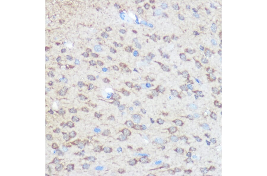 Immunohistochemistry - Anti-Huntingtin Antibody (A308268) - Antibodies.com