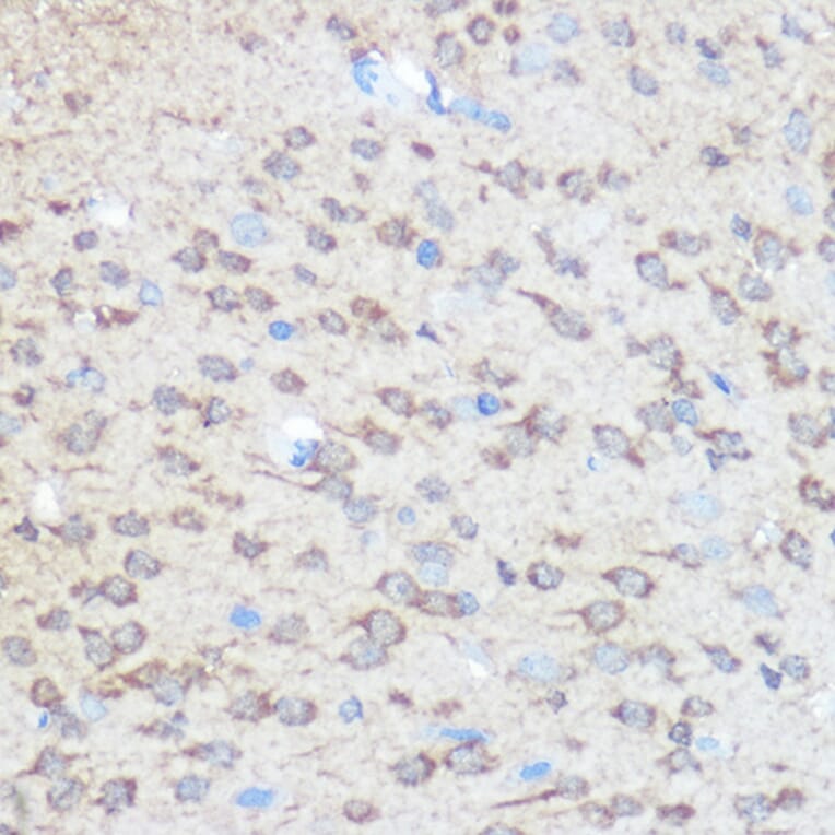 Immunohistochemistry - Anti-Huntingtin Antibody (A308268) - Antibodies.com