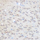 Immunohistochemistry - Anti-Huntingtin Antibody (A308268) - Antibodies.com