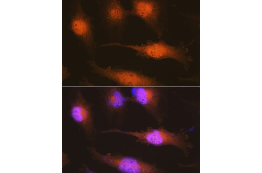 Immunofluorescence - Anti-Huntingtin Antibody (A308268) - Antibodies.com