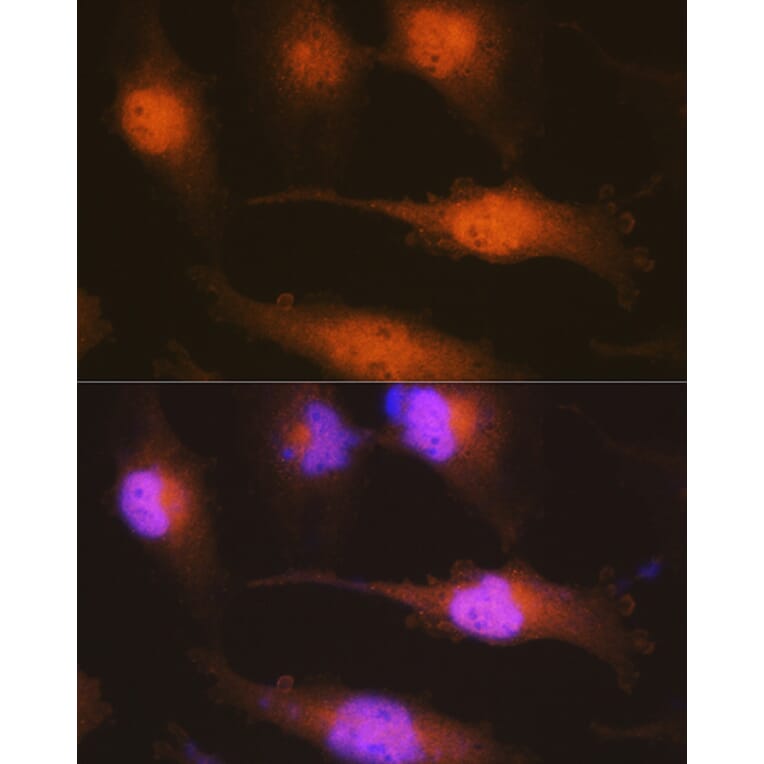 Immunofluorescence - Anti-Huntingtin Antibody (A308268) - Antibodies.com