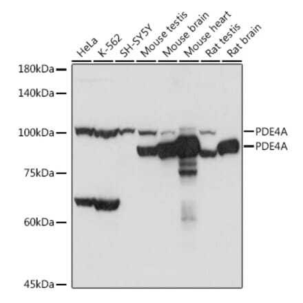 Western Blot - Anti-PDE4A Antibody (A308269) - Antibodies.com