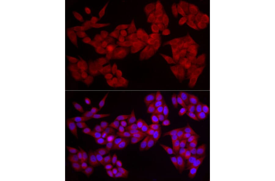 Immunofluorescence - Anti-PDE4A Antibody (A308269) - Antibodies.com
