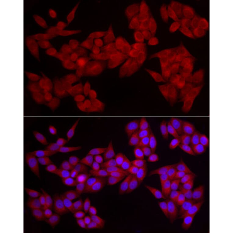 Immunofluorescence - Anti-PDE4A Antibody (A308269) - Antibodies.com