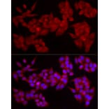 Immunofluorescence - Anti-PDE4A Antibody (A308269) - Antibodies.com