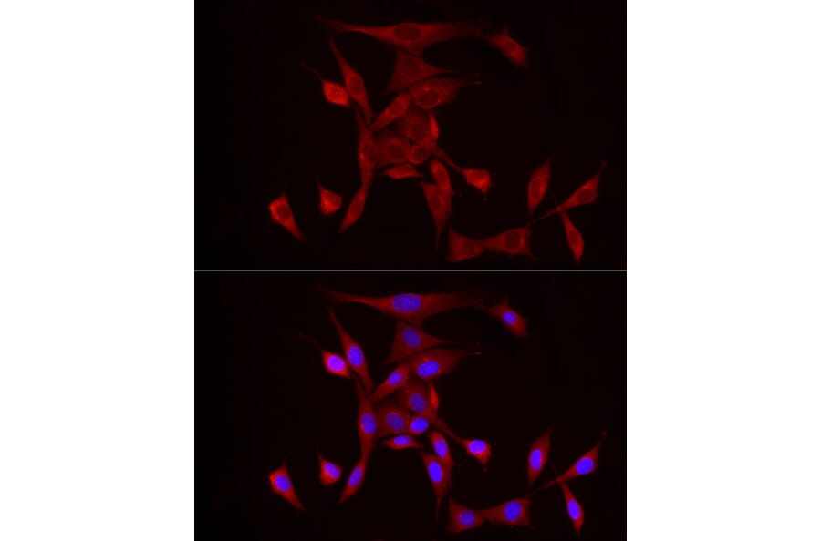 Immunofluorescence - Anti-PDE4A Antibody (A308269) - Antibodies.com
