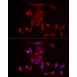 Immunofluorescence - Anti-PDE4A Antibody (A308269) - Antibodies.com