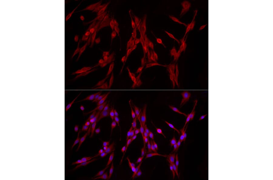 Immunofluorescence - Anti-PDE4A Antibody (A308269) - Antibodies.com