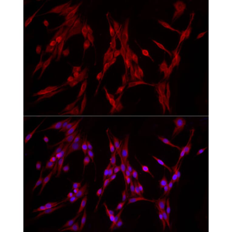 Immunofluorescence - Anti-PDE4A Antibody (A308269) - Antibodies.com