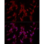 Immunofluorescence - Anti-PDE4A Antibody (A308269) - Antibodies.com