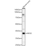 Western Blot - Anti-Constitutive androstane receptor Antibody (A308270) - Antibodies.com