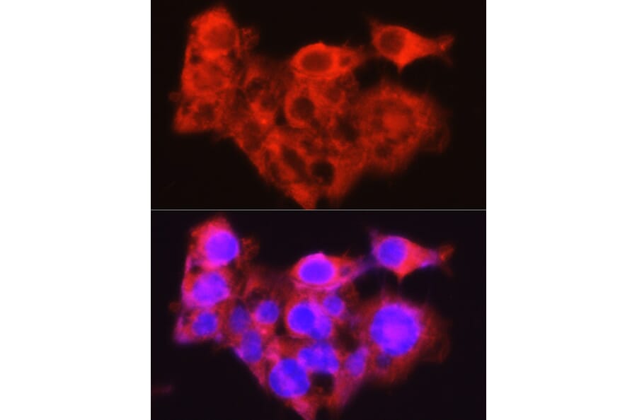 Immunofluorescence - Anti-Constitutive androstane receptor Antibody (A308270) - Antibodies.com