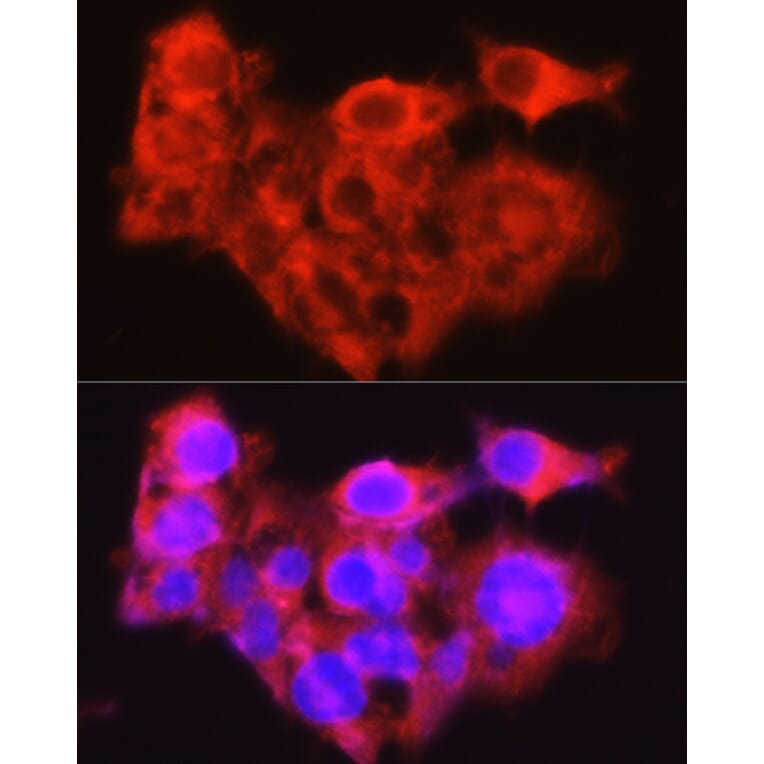 Immunofluorescence - Anti-Constitutive androstane receptor Antibody (A308270) - Antibodies.com