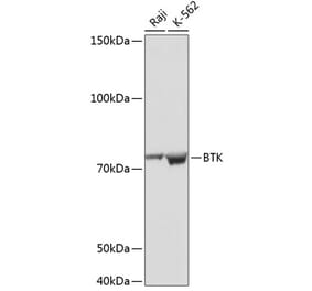 Western Blot - Anti-BTK Antibody [ARC0485] (A308271) - Antibodies.com