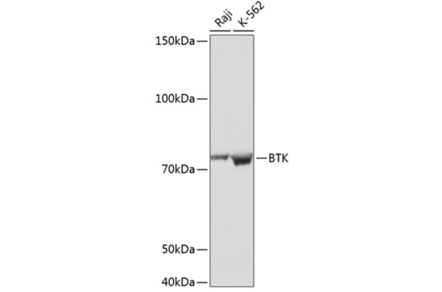 Western Blot - Anti-BTK Antibody [ARC0485] (A308271) - Antibodies.com