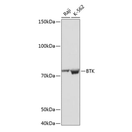 Western Blot - Anti-BTK Antibody [ARC0485] (A308271) - Antibodies.com