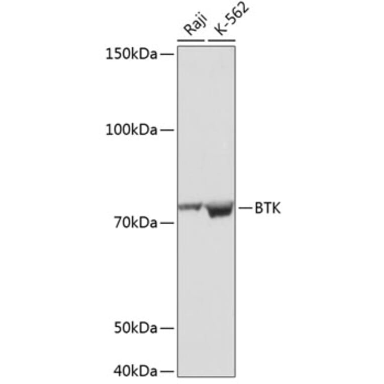 Western Blot - Anti-BTK Antibody [ARC0485] (A308271) - Antibodies.com