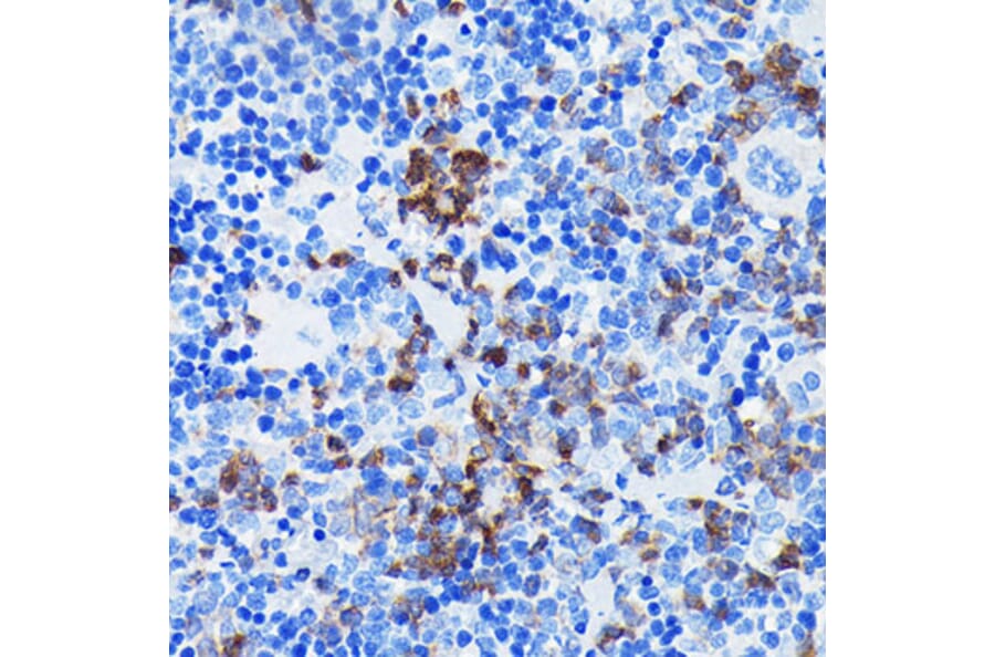 Immunohistochemistry - Anti-BTK Antibody [ARC0485] (A308271) - Antibodies.com