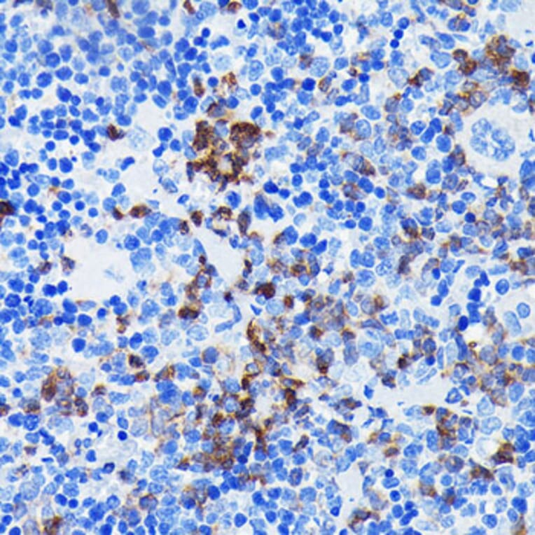 Immunohistochemistry - Anti-BTK Antibody [ARC0485] (A308271) - Antibodies.com