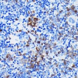Immunohistochemistry - Anti-BTK Antibody [ARC0485] (A308271) - Antibodies.com