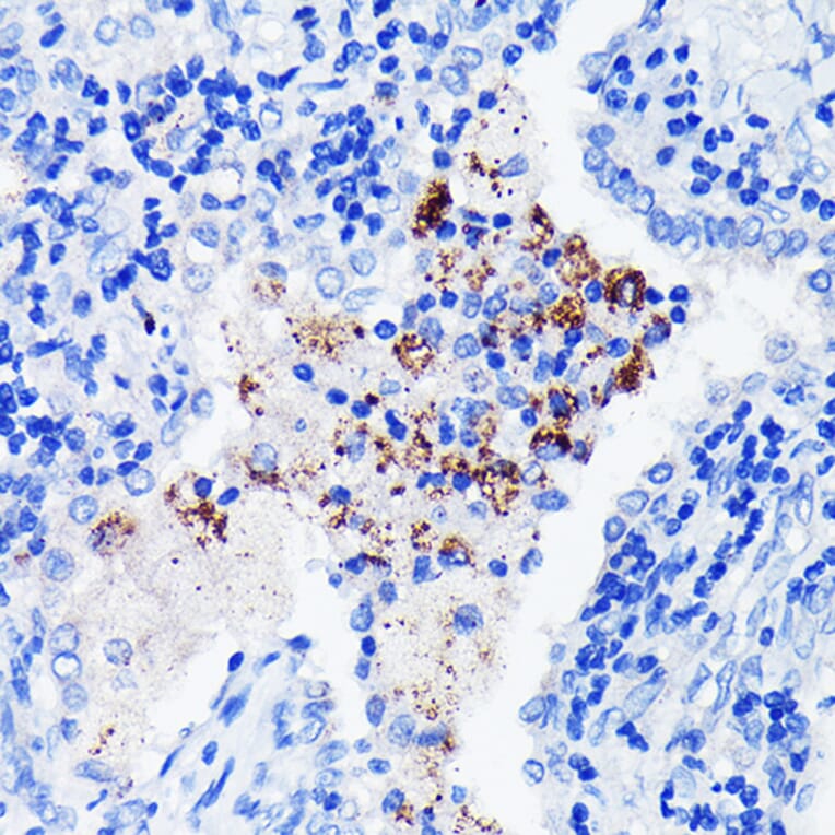 Immunohistochemistry - Anti-BTK Antibody [ARC0485] (A308271) - Antibodies.com