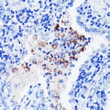 Immunohistochemistry - Anti-BTK Antibody [ARC0485] (A308271) - Antibodies.com