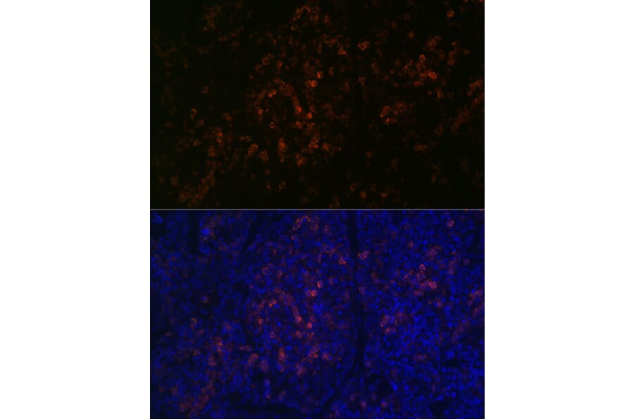 Immunofluorescence - Anti-BTK Antibody [ARC0485] (A308271) - Antibodies.com