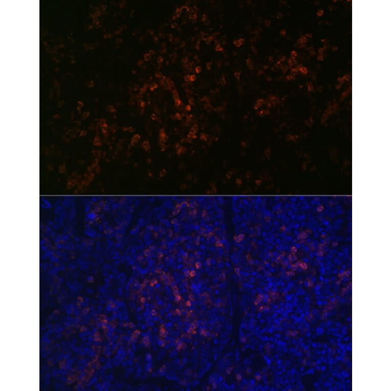 Immunofluorescence - Anti-BTK Antibody [ARC0485] (A308271) - Antibodies.com