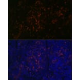 Immunofluorescence - Anti-BTK Antibody [ARC0485] (A308271) - Antibodies.com