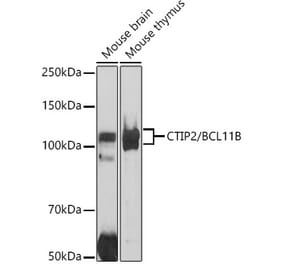 Western Blot - Anti-Ctip2 Antibody (A308272) - Antibodies.com