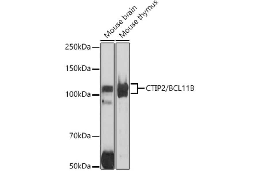 Western Blot - Anti-Ctip2 Antibody (A308272) - Antibodies.com