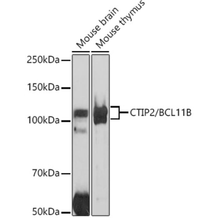 Western Blot - Anti-Ctip2 Antibody (A308272) - Antibodies.com