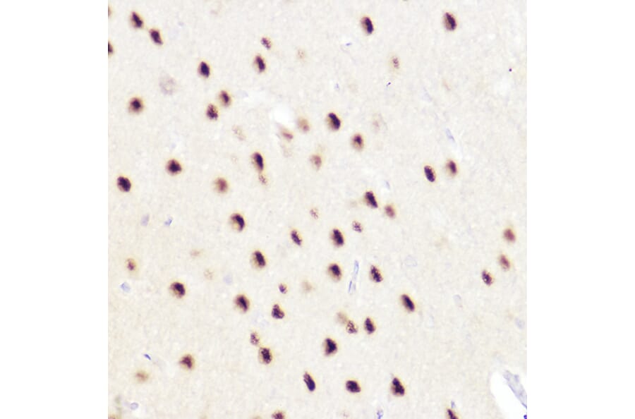 Immunohistochemistry - Anti-Ctip2 Antibody (A308272) - Antibodies.com