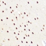 Immunohistochemistry - Anti-Ctip2 Antibody (A308272) - Antibodies.com